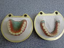 Complete upper and lower wax dentures in the first part of polymeric boxes.