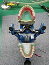 First complete wax dentures in the articulator – modelled and prepared for flasking by Michal.