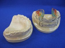 Metzelder appliance with wire tongue barrier