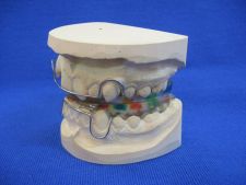 Wunder appliance with Weiss screw