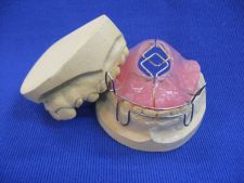 Block appliance with Coffin springs