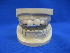 Metzelder appliance with wire tongue barrier