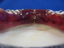 Lower Schwartz plate with Fischer screw