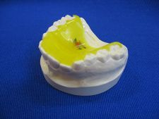 Training palatal plate with a straight wall