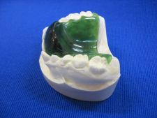 Training palatal plate with oblique wall