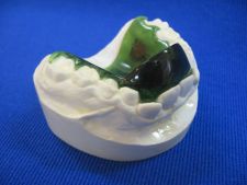 Training palatal plate with oblique wall