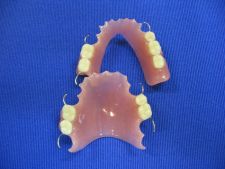 Partial functionally unstable dentures for maxillae and mandible