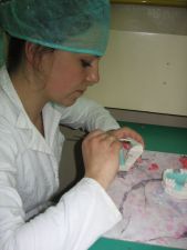 Student - Aleksandra Matczak vel Maciejewska making occlusal rims for partial functionally unstable 
