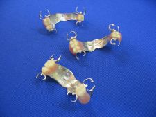Frame dentures
