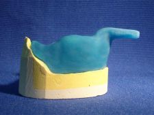 Light cure impression tray