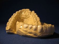 Whitening bite splints