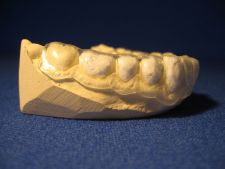Whitening bite splints