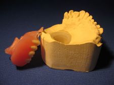 Obturator