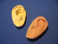 The prosthesis of a right ear