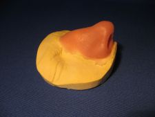 The prosthesis of a nose