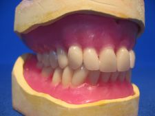 Positioning of teeth VITA PAN