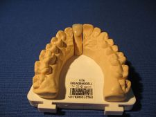 Full-ceramic crown