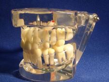 Orthodontics